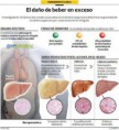 /album/fotogaleria/dano-del-alcohol-jpg/